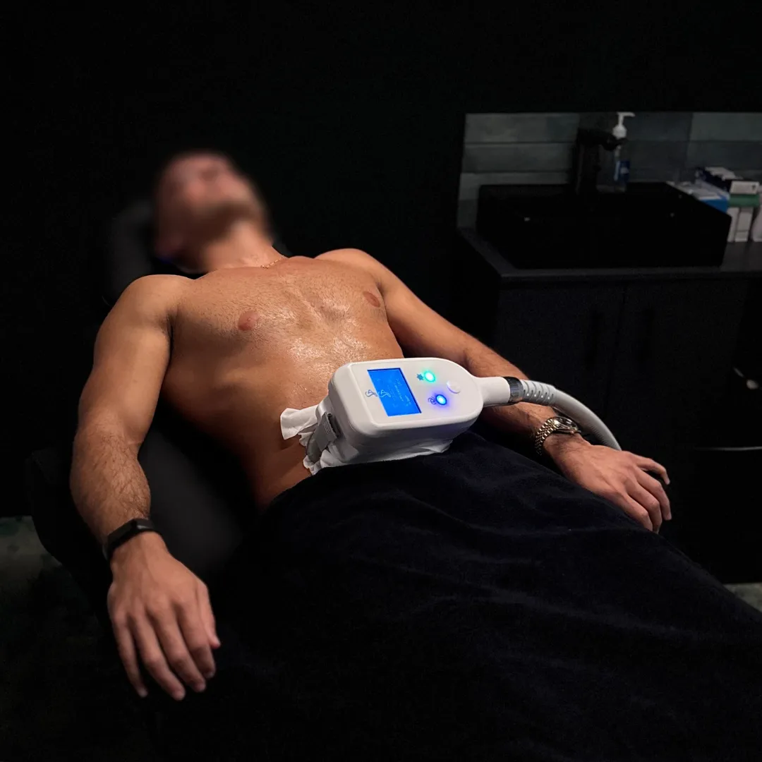 Thriyv offers Cryolipolysis Fat Freezing from our Wellness Clinic in Manchester City Centre