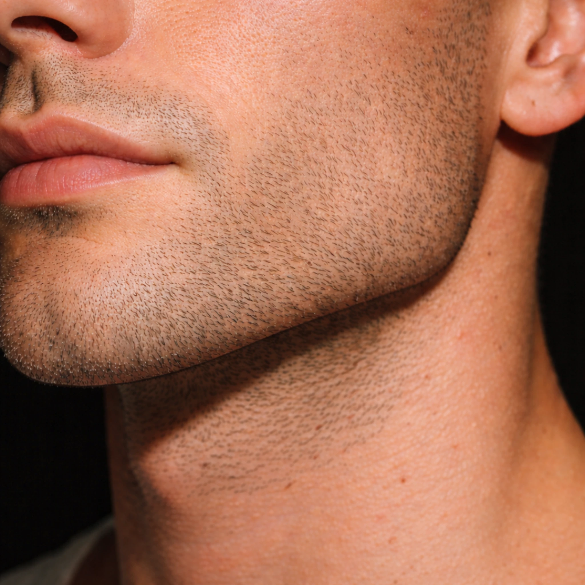Get Jawline Filler in Manchester City Centre at Thriyv Manchester's clinic