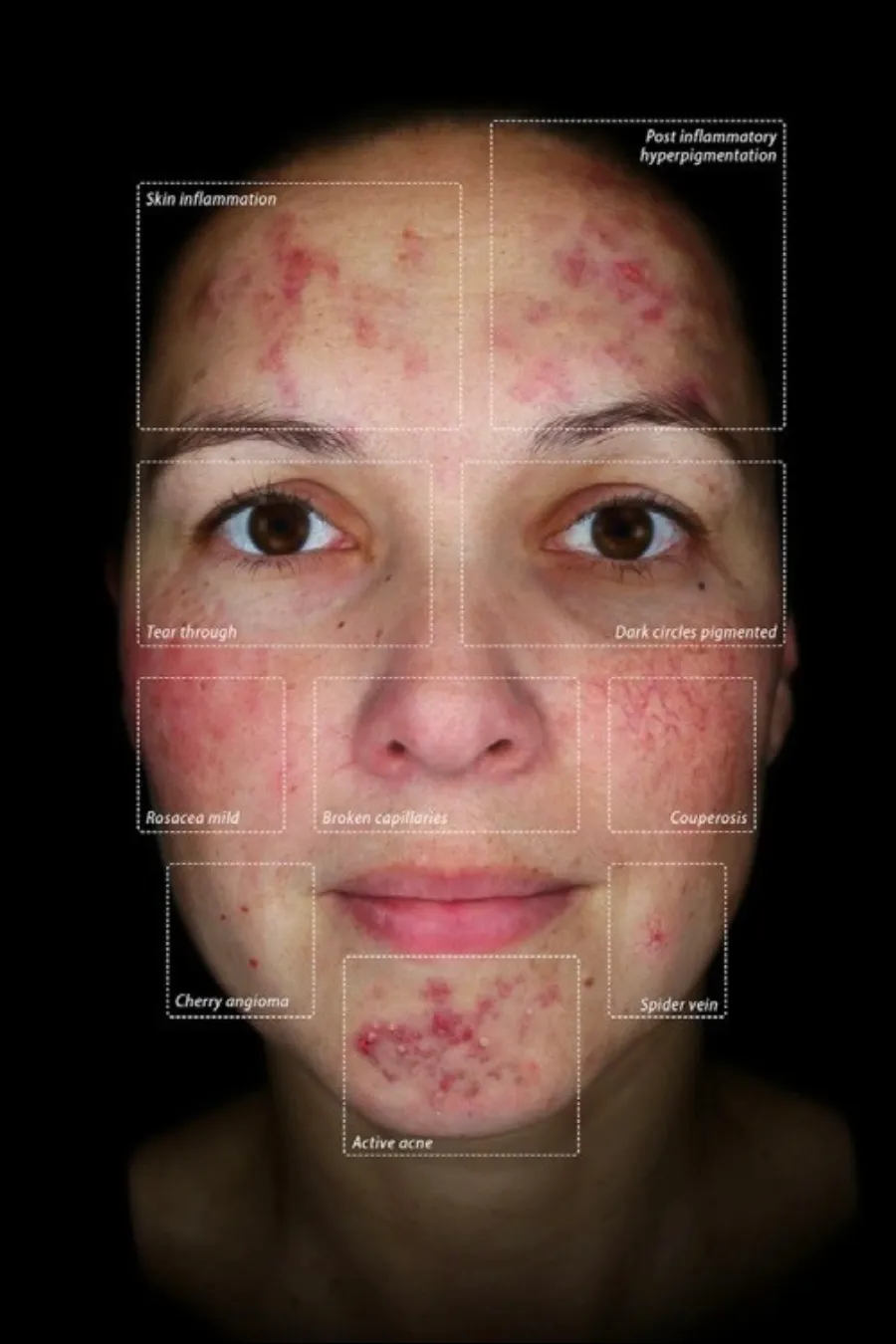 The Observ 520x at Thriyv Wellness and Aesthetics Manchester can be used to offer a clear view of the skin barrier.