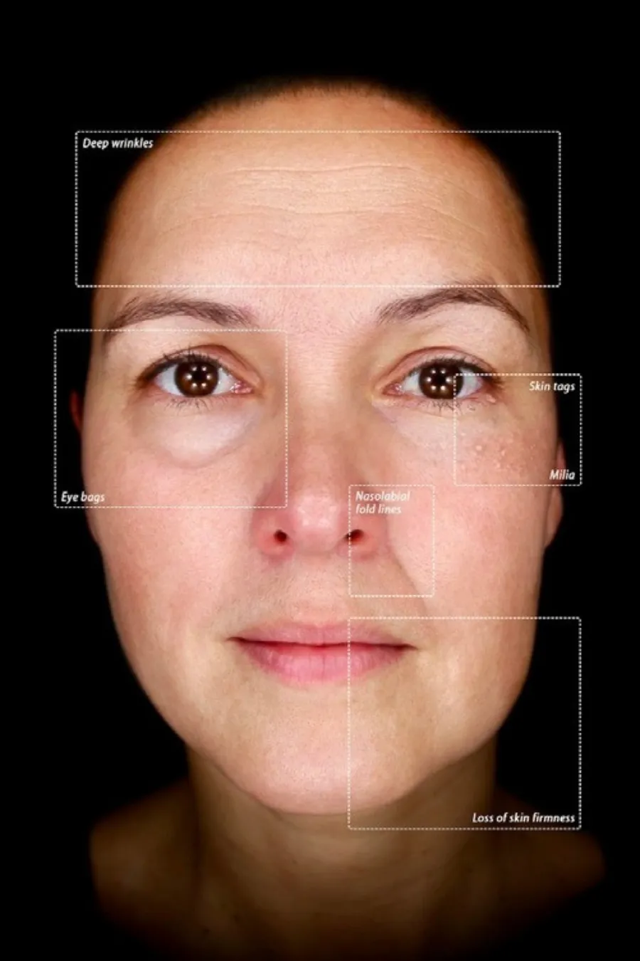 The Observ 520x at CLNiK94 Medical Aesthetics & Skincare Solutions Manchester can be used to log an aesthetic baseline, enabling us to track your progress over successive treatments.