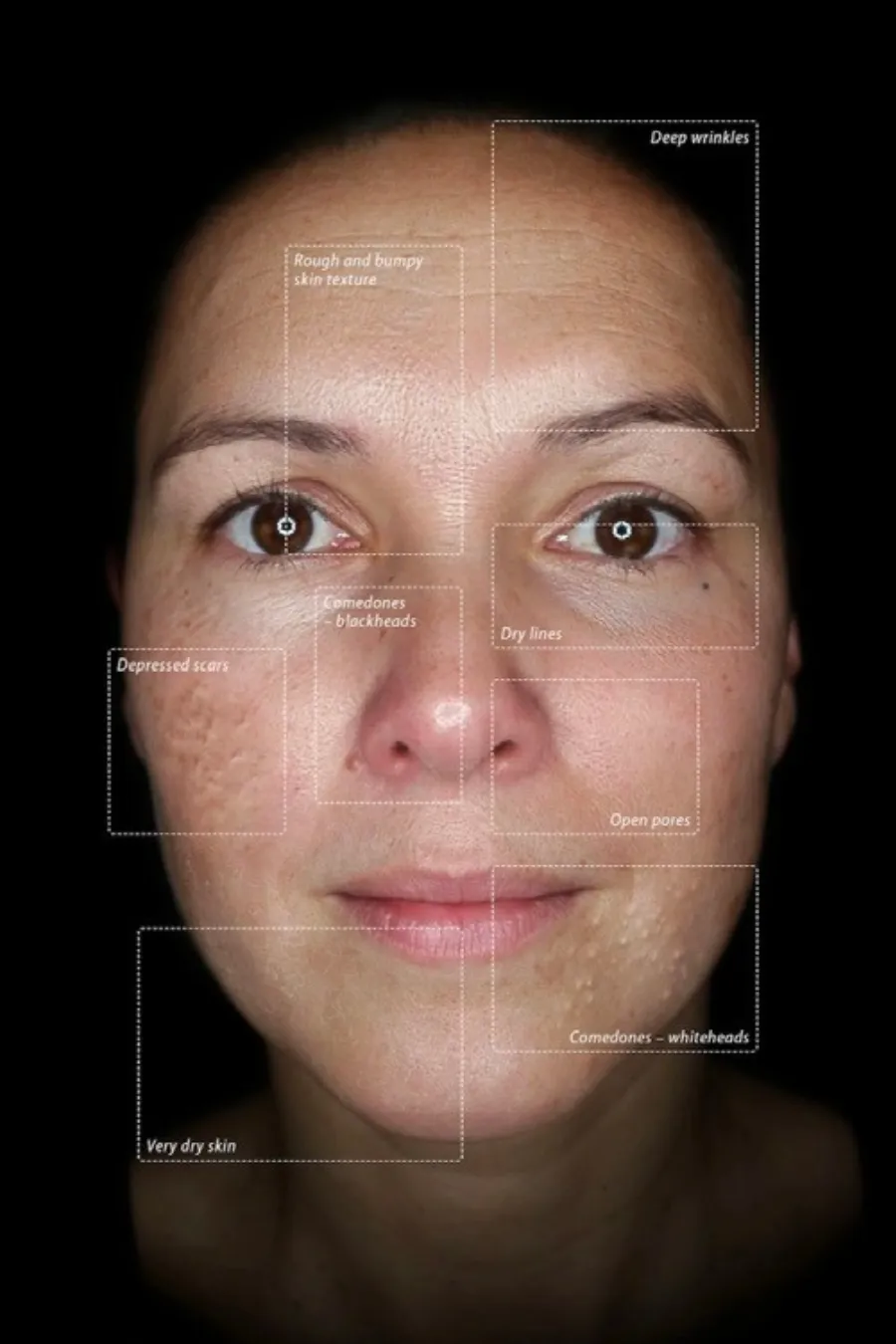 The Observ 520x at CLNiK94 Medical Aesthetics & Skincare Solutions Manchester can be used to accentuate light reflection on the skin’s surface, enhancing texture details and the natural skin glow for precise analysis