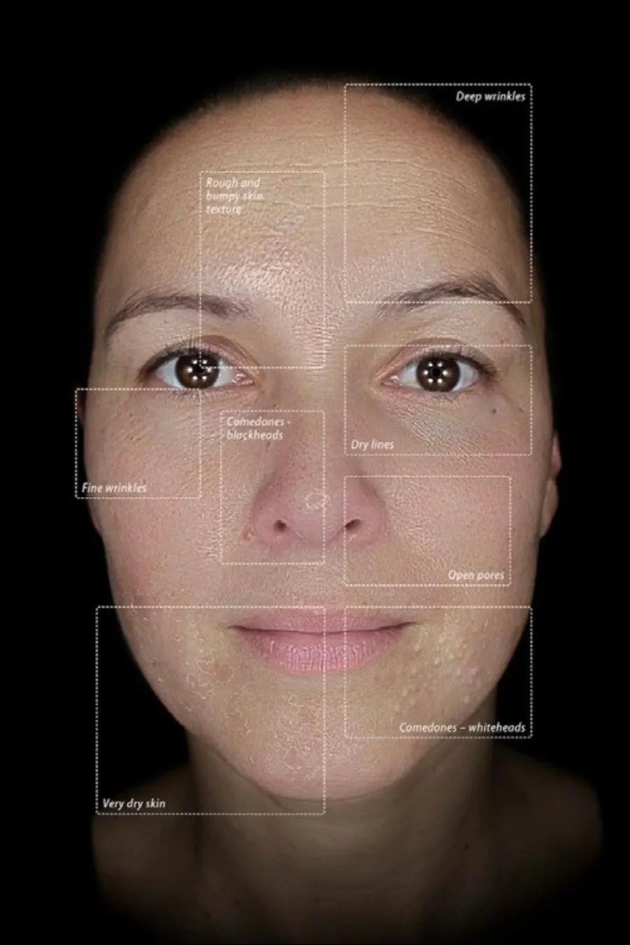 The Observ 520x at Thriyv Wellness and Aesthetics Manchester reveals surface details, highlighting fine lines and skin smoothness for a clear texture view.