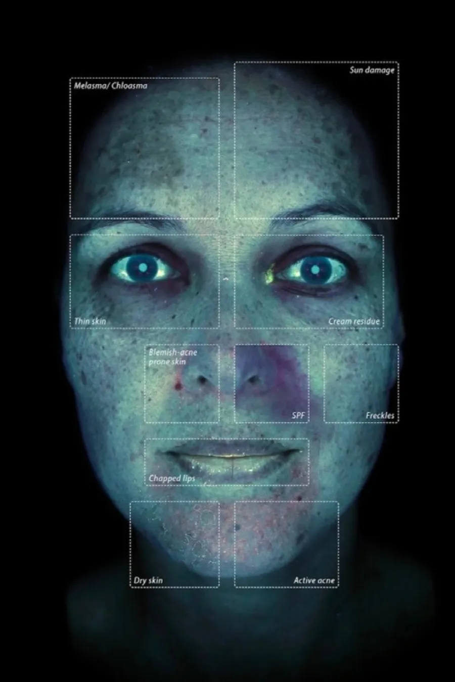 The Observ 520x at Thriyv Wellness and Aesthetics Manchester helps you identify pockets of sun damage and bacterial infections, not visible to the naked eye.