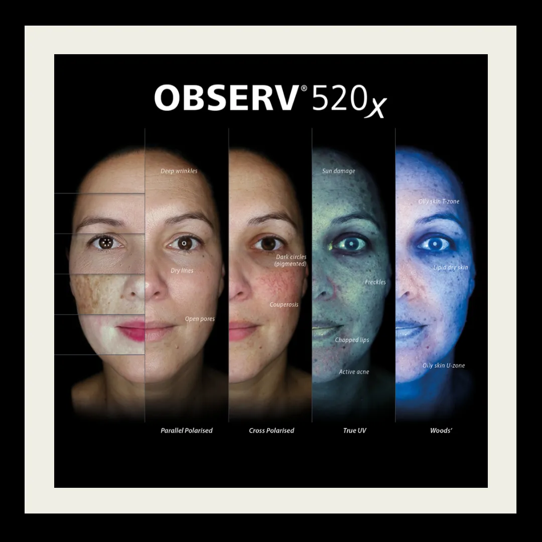 Ready to truly understand your skin? Thriyv runs an Observ 520x Skin Analysis service. This service uses advanced imaging to highlight concerns present in your skin, and produce a report detailing a path to achieving your goals.