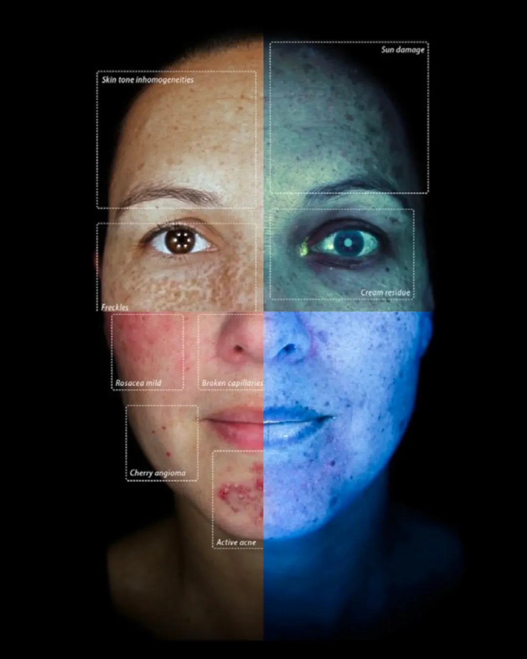 Ready to truly understand your skin? Thriyv runs an Observ 520x Skin Analysis service. This service uses advanced imaging to highlight concerns present in your skin, and produce a report detailing a path to achieving your goals.
